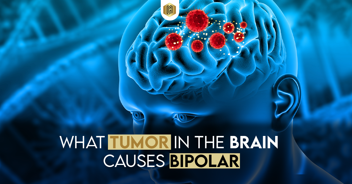 Tumor in the Brain